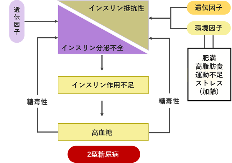 2型糖尿病