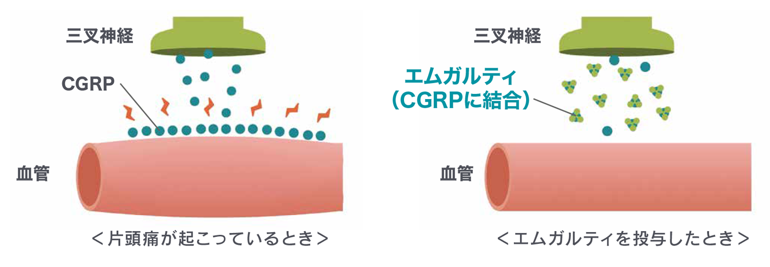 CGRP受容体拮抗薬とは